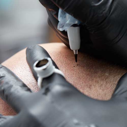 image of the Micropigmentation treatment