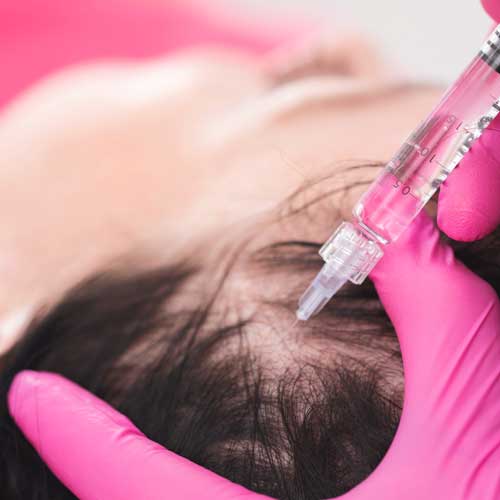 image of the PRP treatment